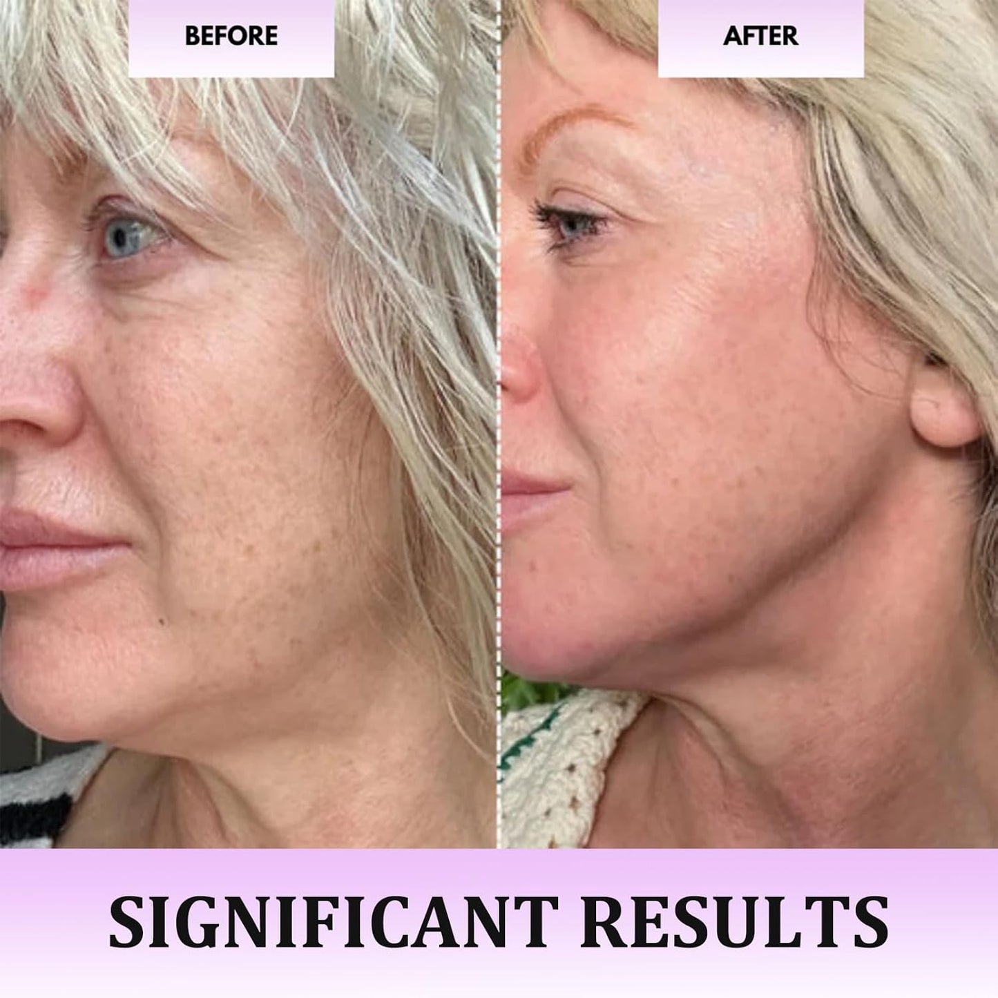 Germanium facial massager in use for under-eye puffiness, wrinkles, and glow boost