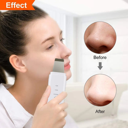 Ultrasonic Skin Scrubber Pro