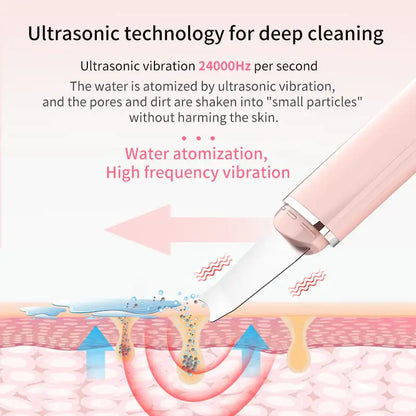 Ultrasonic Skin Scrubber Pro