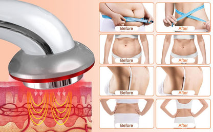 Ellasie Cavitation & Anti-Cellulite Massager Pro - Ellasie